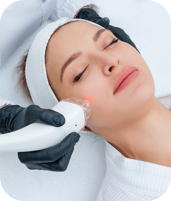 Laser Treatments